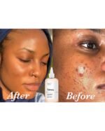 Ordinary glycolic acid 7% exfoliating toner 240 ml - Image 2