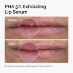 The Ordinary PHA 5% Exfoliating Lip Serum 15ml - Image 5